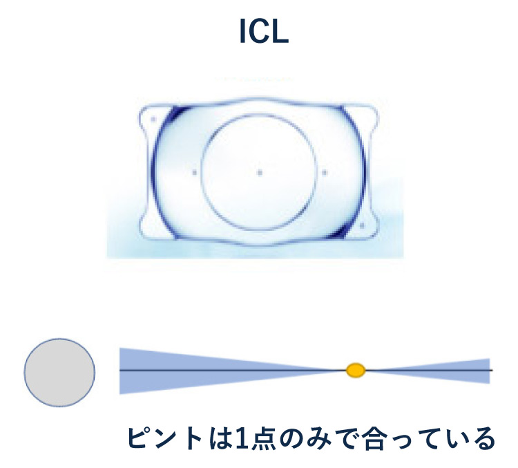 単焦点眼内コンタクトレンズ（ICL）ピントの合い方