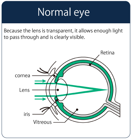 Illustration of normal eyes