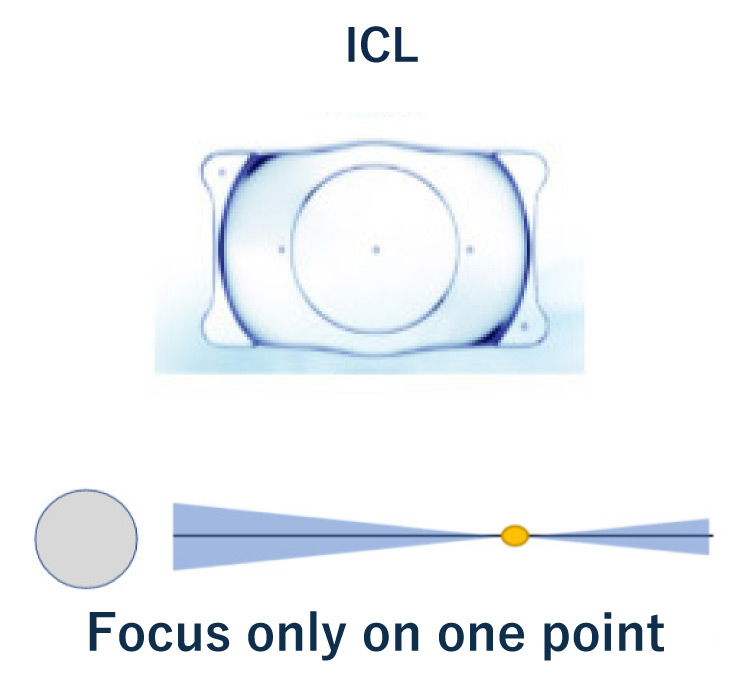 How to focus single focus intraocular contact lens (ICL)