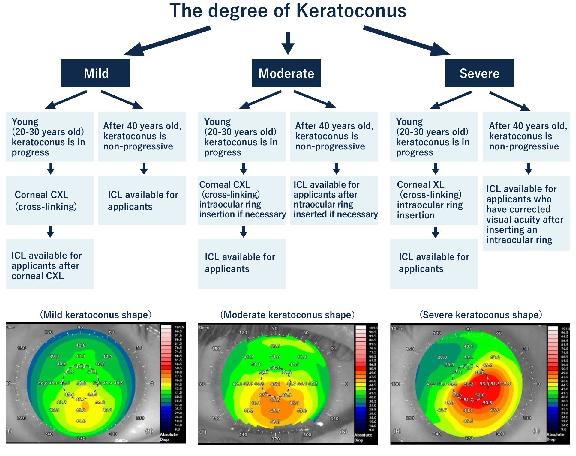 Keratoconus treatment and ICL flow chart
