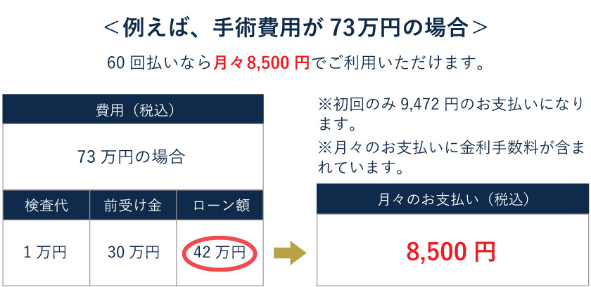 ICL手術73万円の場合の60回払いの分割価格表