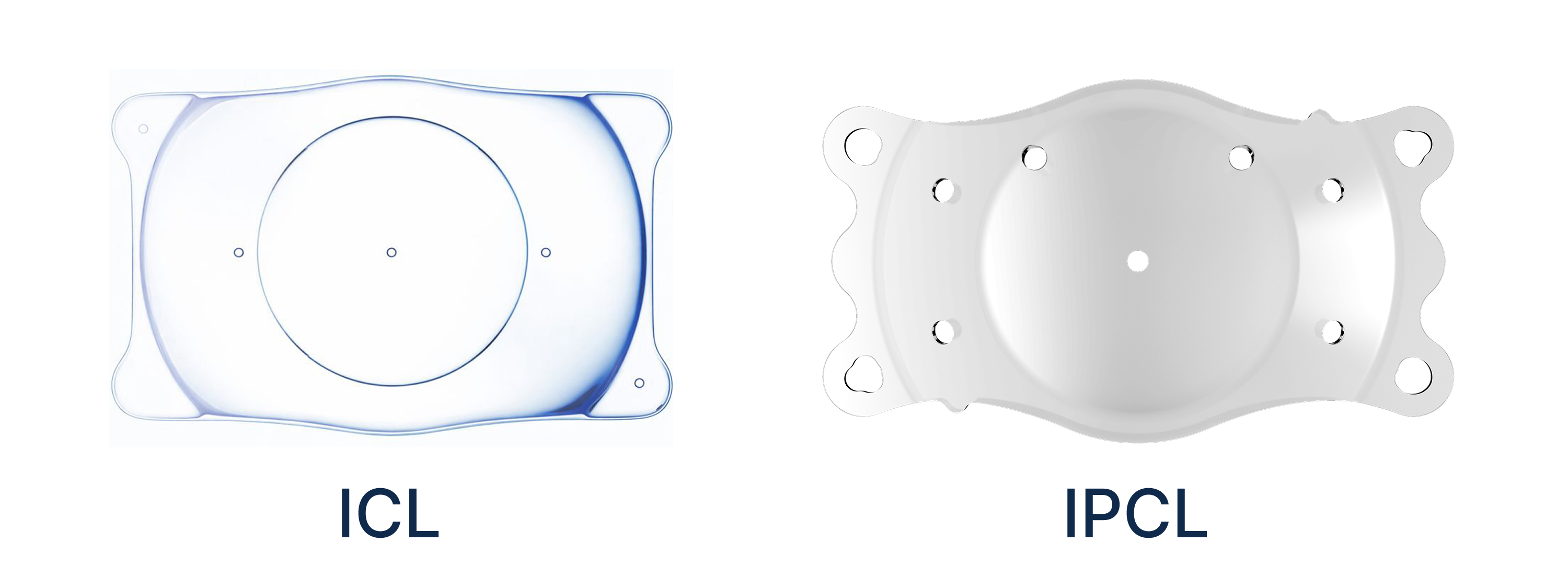 乱視付きICL手術前後の乱視度数