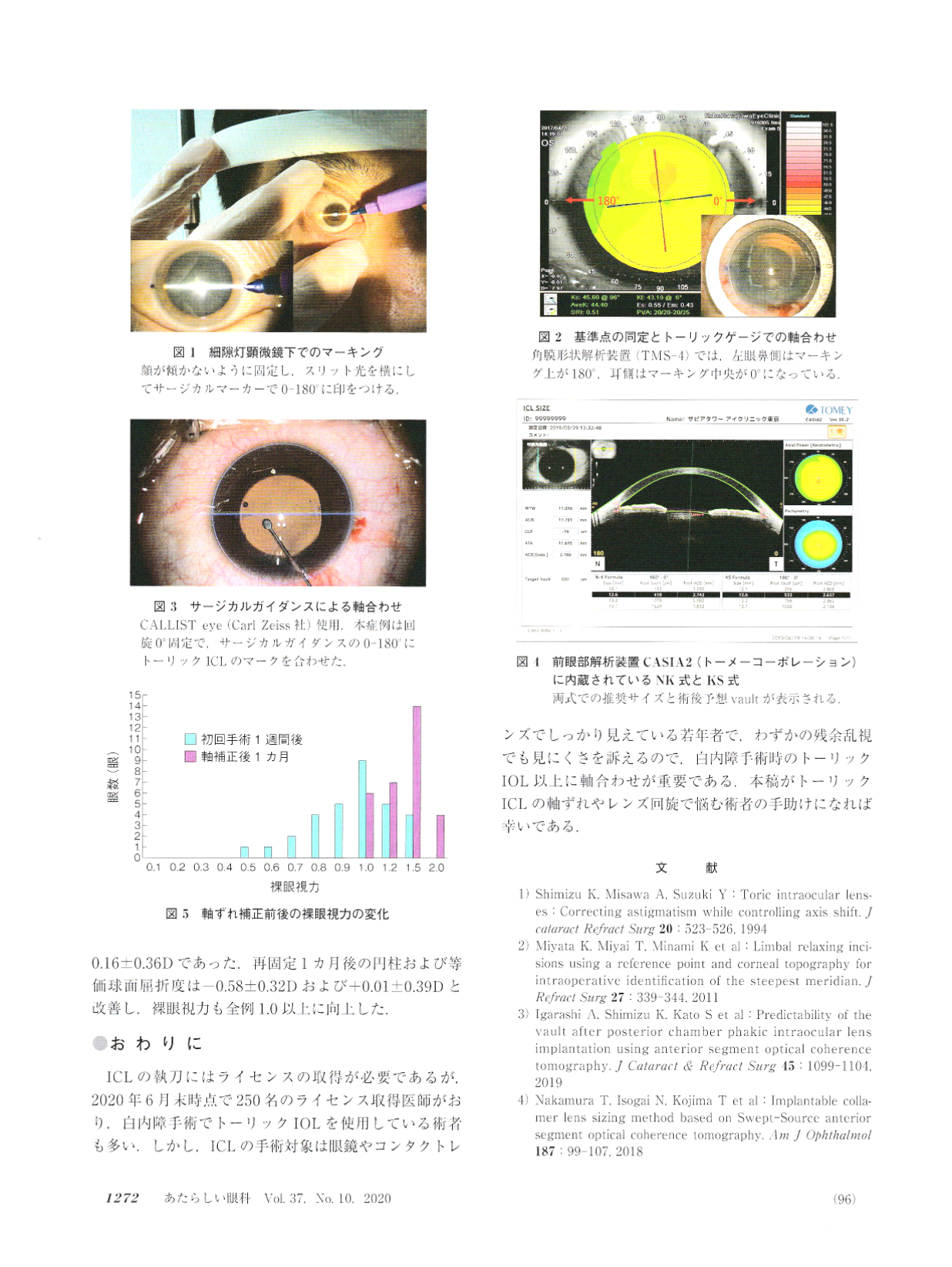 「あたらしい眼科」Vol.37,N0.10,2020に当クリニックの執刀責任者の北澤世志博の記事が掲載