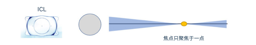 单焦点眼内晶体（ICL）的聚焦方式