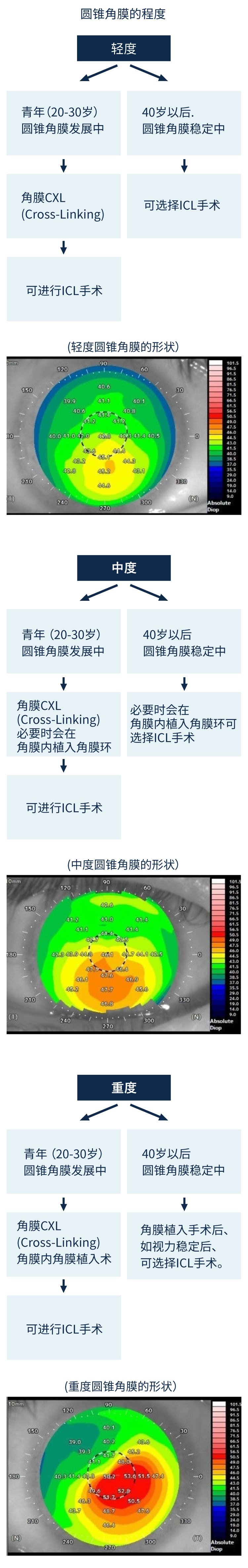 圆锥角膜的治疗和ICL流程图